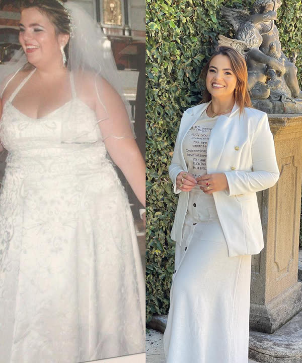 Marília, irmã da Nutri, antes e depois