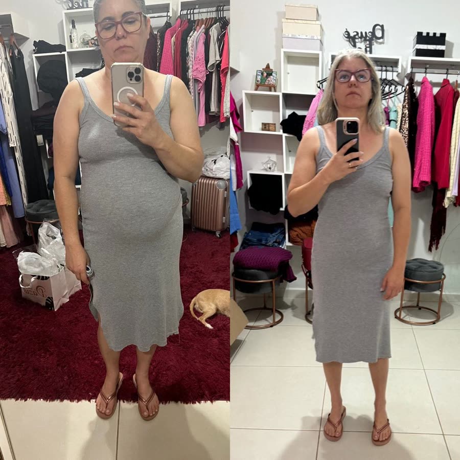 Aluna na menopausa, antes e depois com o mesmo vestido